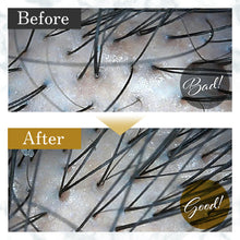 画像をギャラリービューアに読み込む, Lixスカルプシャンプー(350ml)