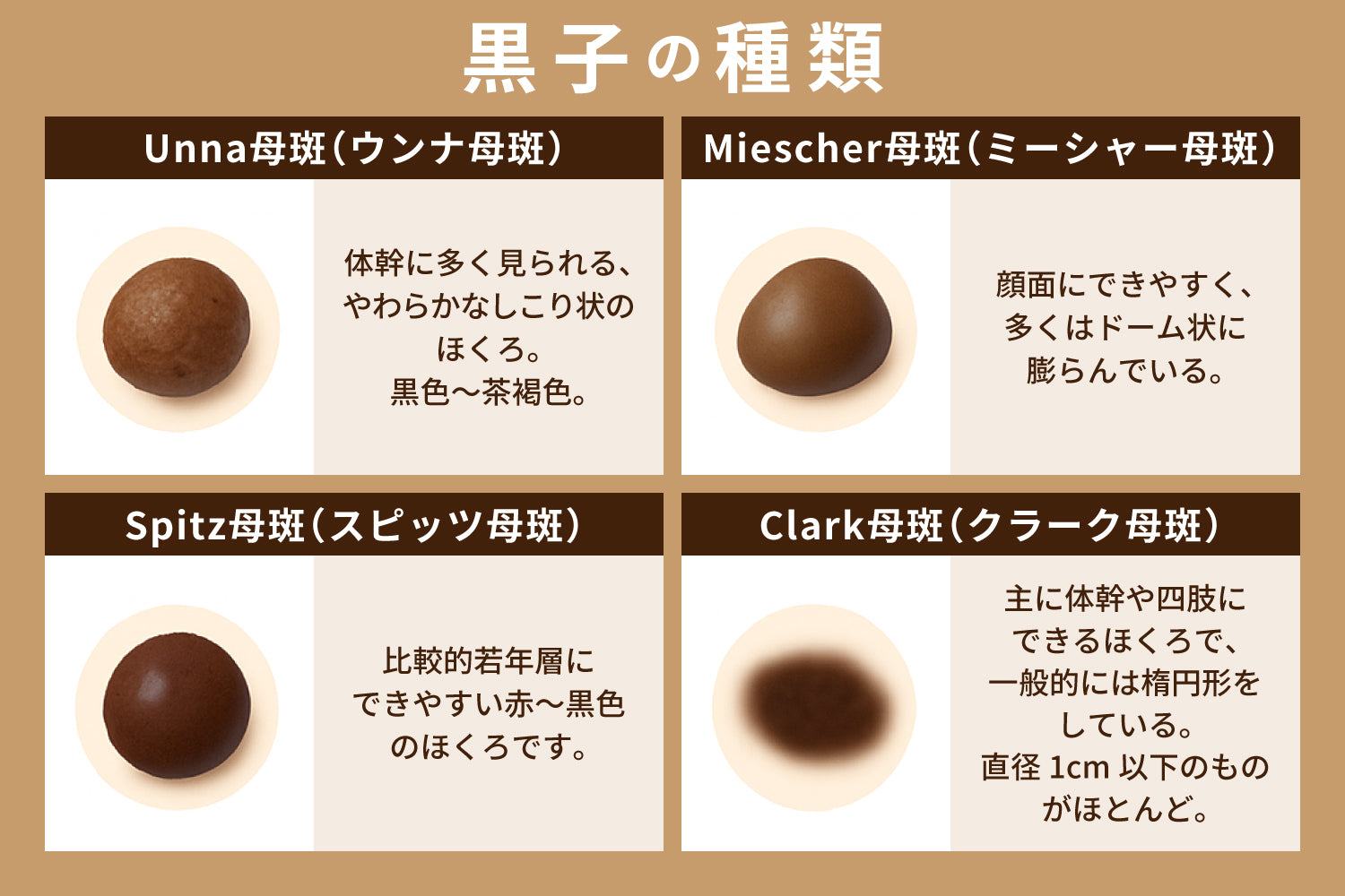 ほくろが急にできるのはなぜ？その原因と見逃せない危険なサインを解説