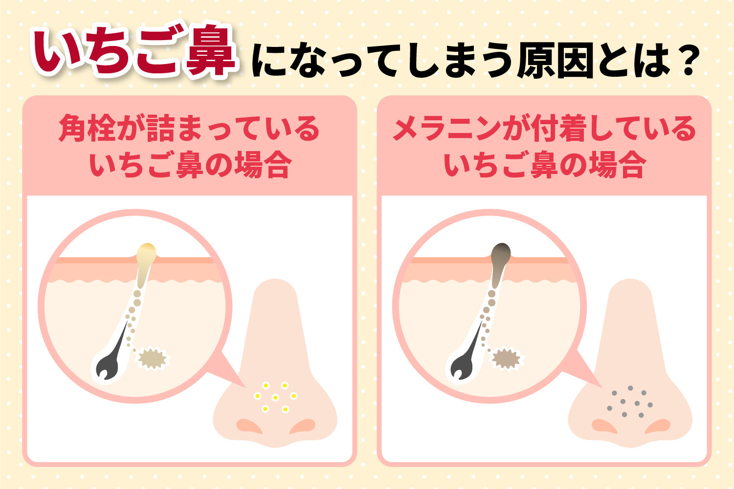 いちご鼻はクレンジングで治る？治らないと言われる原因や頻度をご紹介！