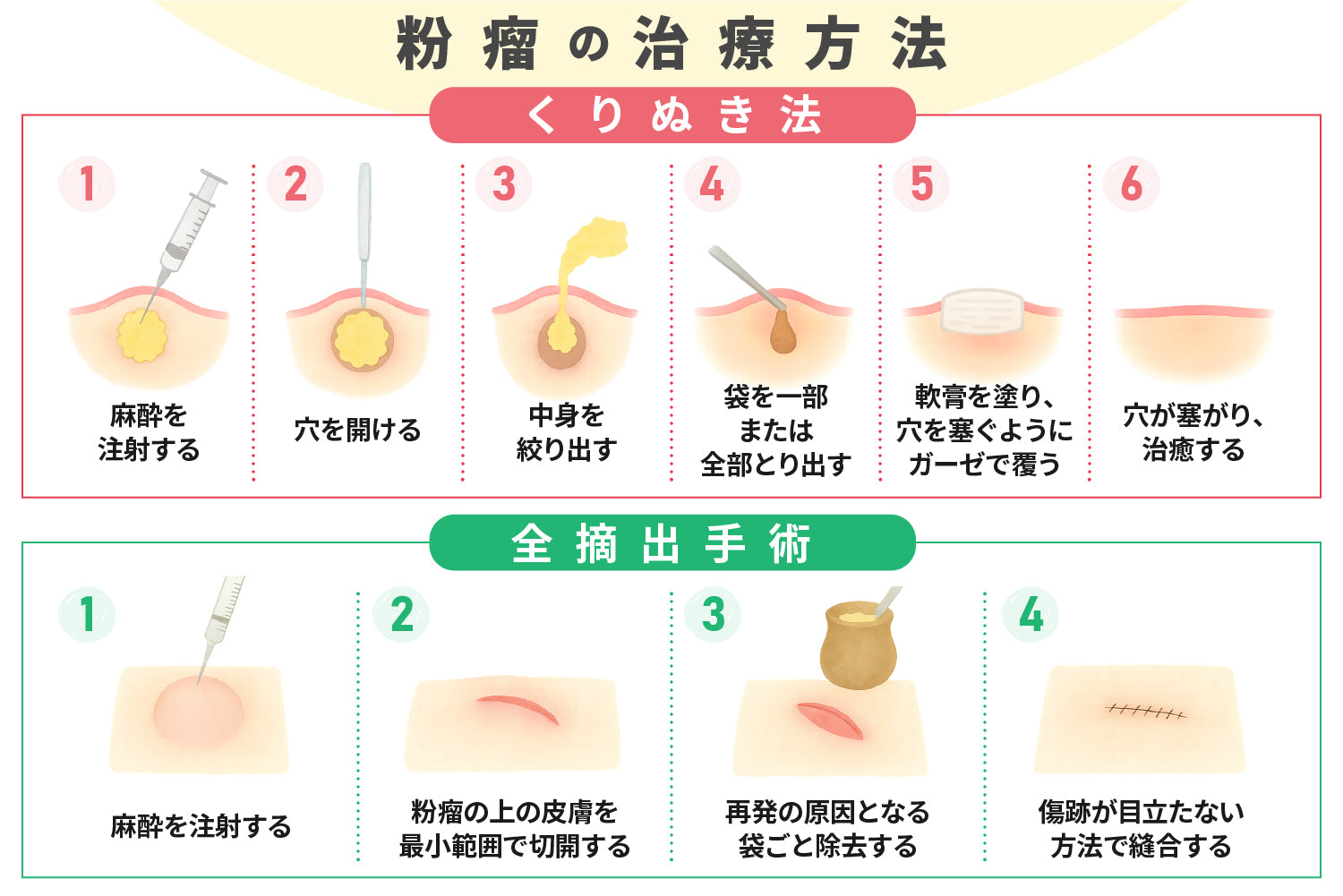 顔にできる粉瘤（ふんりゅう）は放置しても良い？原因や治療法をご紹介！