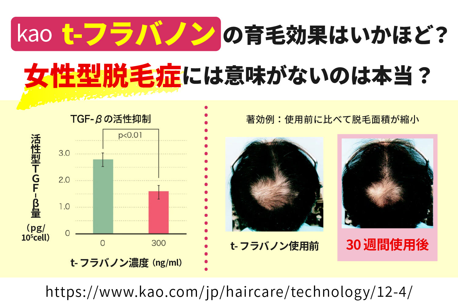 t-フラバノンの育毛効果はいかほど？女性型脱毛症には意味がないのは本当？